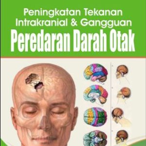 Buku Ajar Peningkatan Tekanan Intrakranial dan Gangguan Peredaran Darah Otak