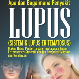 Apa dan Bagaimana Penyakit Lupus ? (Sistemik Lupus Eritematosus)