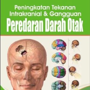 Buku Ajar Peningkatan Tekanan Intrakranial dan Gangguan Peredaran Darah Otak